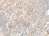 Immunohistochemistry of paraffin-embedded Human tonsil tissue  using HBE1 Polyclonal Antibody at dilution of 1:30(×200)