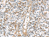 Immunohistochemistry of paraffin-embedded Human tonsil tissue  using NPC2 Polyclonal Antibody at dilution of 1:80(×200)