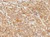 Immunohistochemistry of paraffin-embedded Human tonsil tissue  using JPT1 Polyclonal Antibody at dilution of 1:35(×200)