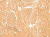 Immunohistochemistry of paraffin-embedded Human brain tissue  using PPP1R1A Polyclonal Antibody at dilution of 1:50(×200)