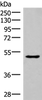 Western blot analysis of Mouse Pancreas tissue lysate  using NKD2 Polyclonal Antibody at dilution of 1:350