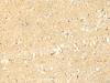 Immunohistochemistry of paraffin-embedded Human brain tissue  using POLR3F Polyclonal Antibody at dilution of 1:50(×200)