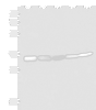 Western blot analysis of 293T HepG2 and A549 cell lysates  using ECH1 Polyclonal Antibody at dilution of 1:200