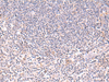 Immunohistochemistry of paraffin-embedded Human tonsil tissue  using DHPS Polyclonal Antibody at dilution of 1:75(×200)