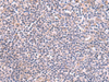 Immunohistochemistry of paraffin-embedded Human tonsil tissue  using GMDS Polyclonal Antibody at dilution of 1:70(×200)