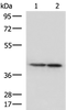 Western blot analysis of Human cerebella tissue and Human cerebrum tissue lysates  using ATP6V1C1 Polyclonal Antibody at dilution of 1:500