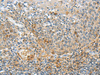 Immunohistochemistry of paraffin-embedded Human tonsil tissue  using RMDN2 Polyclonal Antibody at dilution of 1:70(×200)