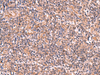 Immunohistochemistry of paraffin-embedded Human tonsil tissue  using UBAC1 Polyclonal Antibody at dilution of 1:50(×200)