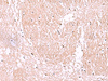 Immunohistochemistry of paraffin-embedded Human brain tissue  using RIC8A Polyclonal Antibody at dilution of 1:55(×200)