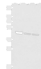 Western blot analysis of Human fetal liver tissue PC-3 and A172 cell lysates  using SCCPDH Polyclonal Antibody at dilution of 1:1000