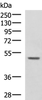 Western blot analysis of 293T cell lysate  using GALK2 Polyclonal Antibody at dilution of 1:1350