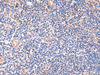 Immunohistochemistry of paraffin-embedded Human tonsil tissue  using ZNF256 Polyclonal Antibody at dilution of 1:120(×200)
