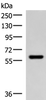 Western blot analysis of Mouse skeletal muscle tissue lysate  using MYOT Polyclonal Antibody at dilution of 1:900