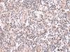 Immunohistochemistry of paraffin-embedded Human tonsil tissue  using GSPT2 Polyclonal Antibody at dilution of 1:50(×200)