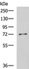 Western blot analysis of K562 cell lysate  using GSTCD Polyclonal Antibody at dilution of 1:800