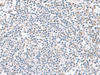 Immunohistochemistry of paraffin-embedded Human tonsil tissue  using PAM16 Polyclonal Antibody at dilution of 1:60(×200)