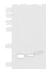 Western blot analysis of Rat kidney tissue Mouse liver tissue and Human fetal liver tissue lysates  using RIDA Polyclonal Antibody at dilution of 1:600