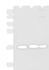 Western blot analysis of 231 HL60 and Jurkat cell lysates  using RPS14 Polyclonal Antibody at dilution of 1:700