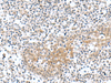 Immunohistochemistry of paraffin-embedded Human tonsil tissue  using TNNC2 Polyclonal Antibody at dilution of 1:50(×200)