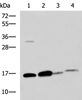 Western blot analysis of Human sigmoid tissue Mouse large intestine tissue Mouse small intestines tissue Mouse Pancreas tissue lysates  using ZG16 Polyclonal Antibody at dilution of 1:800