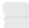 Western blot analysis of 293T K562 and HepG2 cell lysates  using BLOC1S6 Polyclonal Antibody at dilution of 1:650