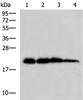 Western blot analysis of Rat brain tissue Hela HepG2 and A172 cell lysates  using HPCAL1 Polyclonal Antibody at dilution of 1:1000
