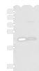 Western blot analysis of HepG2 and A549 cell lysates  using CSRP2 Polyclonal Antibody at dilution of 1:900