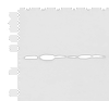 Western blot analysis of NIH/3T3 cell Mouse Pancreas tissue Rat lung tissue Mouse liver tissue Hela Raji cell lysates  using TMED10 Polyclonal Antibody at dilution of 1:900