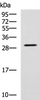 Western blot analysis of SP20 cell lysate  using LRAT Polyclonal Antibody at dilution of 1:800
