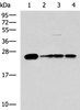 Western blot analysis of 293T LO2 and HepG2 cell lysates  using MMAB Polyclonal Antibody at dilution of 1:1400