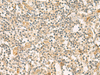 Immunohistochemistry of paraffin-embedded Human tonsil tissue  using HHIPL2 Polyclonal Antibody at dilution of 1:55(×200)