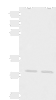 Western blot analysis of Mouse brain tissue Mouse kidney tissue lysates  using KRCC1 Polyclonal Antibody at dilution of 1:1350