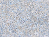 Immunohistochemistry of paraffin-embedded Human tonsil tissue  using PYCR2 Polyclonal Antibody at dilution of 1:40(×200)