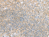 Immunohistochemistry of paraffin-embedded Human tonsil tissue  using TSTA3 Polyclonal Antibody at dilution of 1:45(×200)