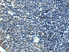 Immunohistochemistry of paraffin-embedded Human tonsil tissue  using PRRT2 Polyclonal Antibody at dilution of 1:40(×200)