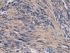 Immunohistochemistry of paraffin-embedded Human brain tissue  using ICA1 Polyclonal Antibody at dilution of 1:70(×200)