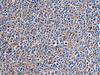 Immunohistochemistry of paraffin-embedded Human tonsil tissue  using CEP89 Polyclonal Antibody at dilution of 1:95(×200)
