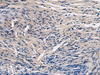 Immunohistochemistry of paraffin-embedded Human brain tissue  using CYTIP Polyclonal Antibody at dilution of 1:50(×200)