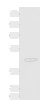 Western blot analysis of Hela cell lysate  using ARPC1B Polyclonal Antibody at dilution of 1:1000