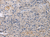 Immunohistochemistry of paraffin-embedded Human brain tissue  using SLC30A3 Polyclonal Antibody at dilution of 1:55(×200)