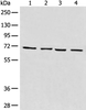 Western blot analysis of 293T cell Human heart tissue Raji and LNCAP cell lysates  using MAPK4 Polyclonal Antibody at dilution of 1:550