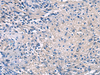 Immunohistochemistry of paraffin-embedded Human brain tissue  using PROKR2 Polyclonal Antibody at dilution of 1:40(×200)