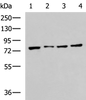 Western blot analysis of RAW264.7 MCF7 Jurkat and A431 cell lysates  using HSPA5 Polyclonal Antibody at dilution of 1:400