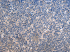 Immunohistochemistry of paraffin-embedded Human tonsil tissue  using HSPA5 Polyclonal Antibody at dilution of 1:35(×200)
