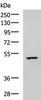 Western blot analysis of MCF7 cell lysate  using CKMT1A/CKMT1B Polyclonal Antibody at dilution of 1:600