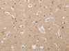 Immunohistochemistry of paraffin-embedded Human brain tissue  using P2RY11 Polyclonal Antibody at dilution of 1:30(×200)