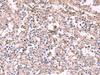 Immunohistochemistry of paraffin-embedded Human tonsil tissue  using ADH1B Polyclonal Antibody at dilution of 1:55(×200)