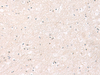 Immunohistochemistry of paraffin-embedded Human brain tissue  using FGFR4 Polyclonal Antibody at dilution of 1:25(×200)