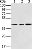 Western blot analysis of 293T K562 and Raji cell  using DCX Polyclonal Antibody at dilution of 1:400