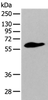 Western blot analysis of Human prostate tissue  using STEAP2 Polyclonal Antibody at dilution of 1:400